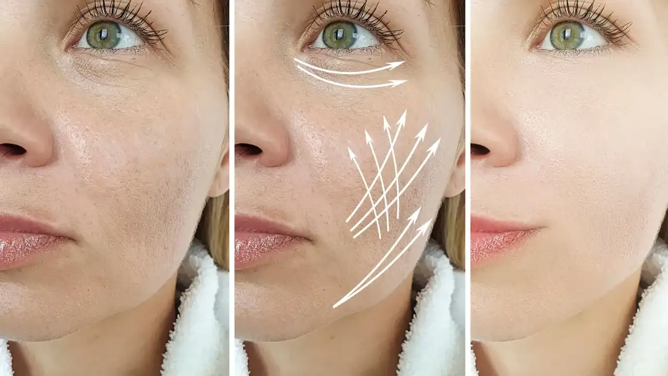 Can One Treatment Really Tackle More Than One Skin Concern Aylesbury?