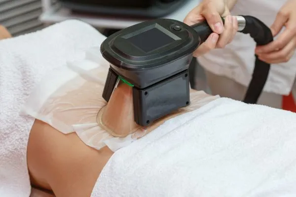 Image of person having fat freezing treatment to help weight gain Aylesbury