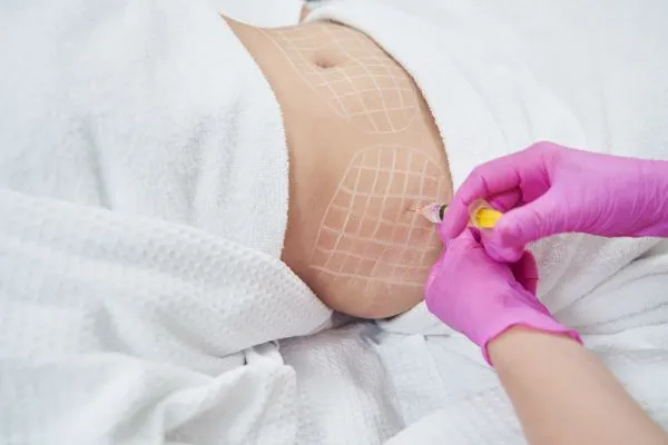 image of fat dissolving injections on love handles to help combat weight gain Aylesbury