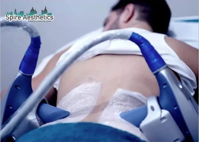 Man having fat freezing treatment done on love handles before a competitions Aylesbury to create a sculpted look.