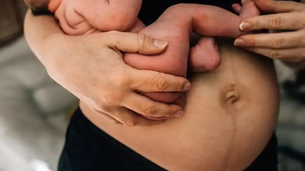 Why Is My Stomach Still Big After Pregnancy Aylesbury?